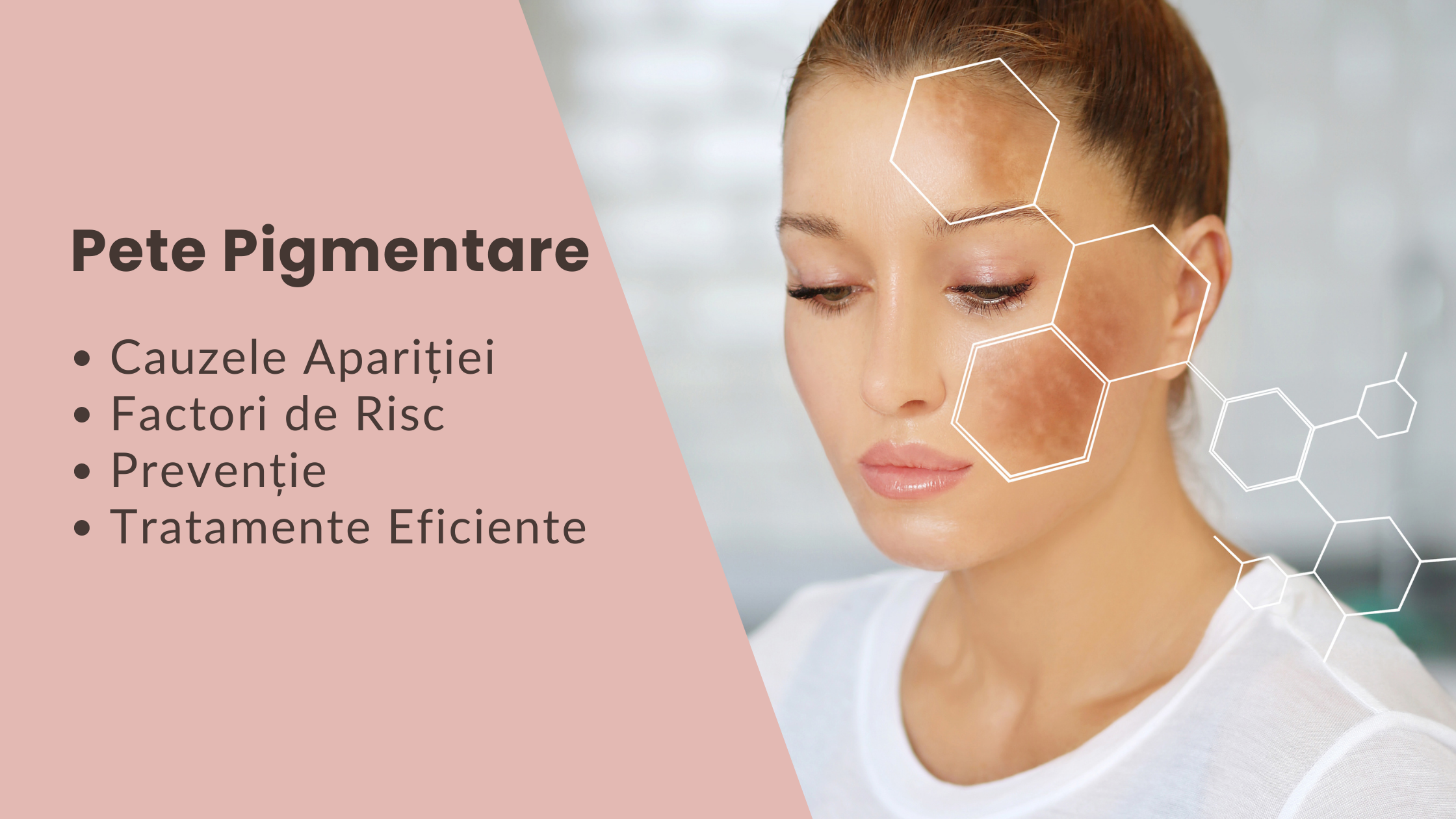 Petele pigmentare cauze factori de risc si tratamente