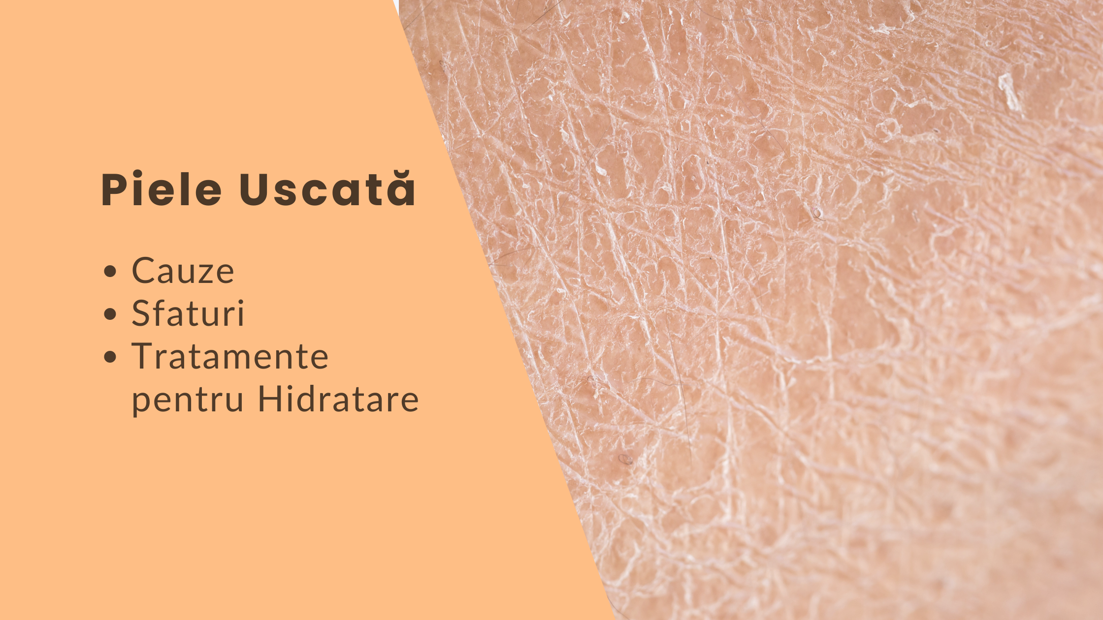 Piele uscata pe fata 
